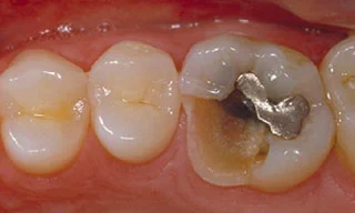 Emergency Dentistry in Scarborough