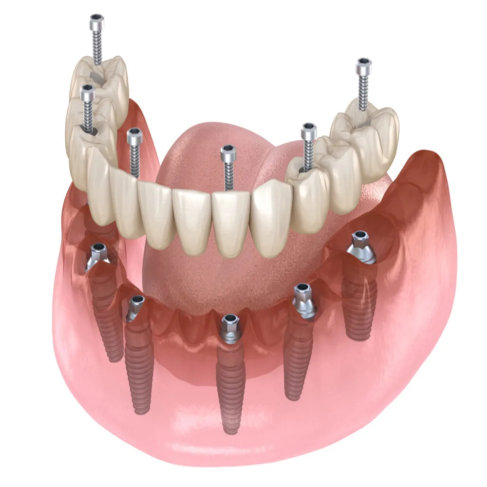 Dentures in Scarborough