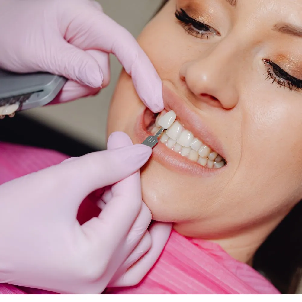 Porcelain Veneers in Scarborough
