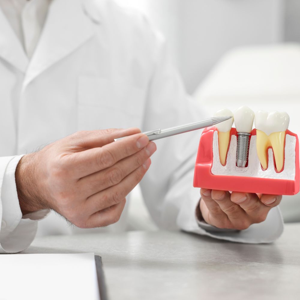 Dental Implants in Scarborough