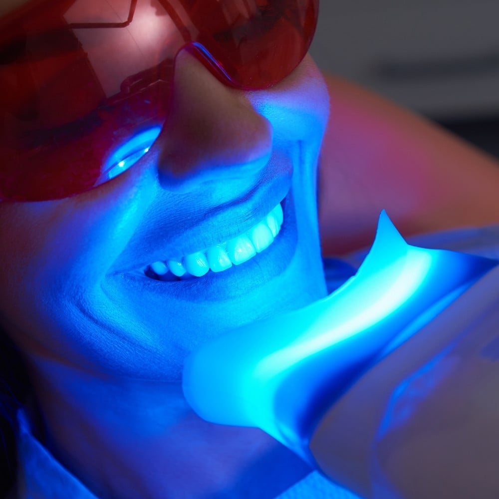female patient getting professional teeth whitening at Everbright Smiles dental clinic Scarborough.