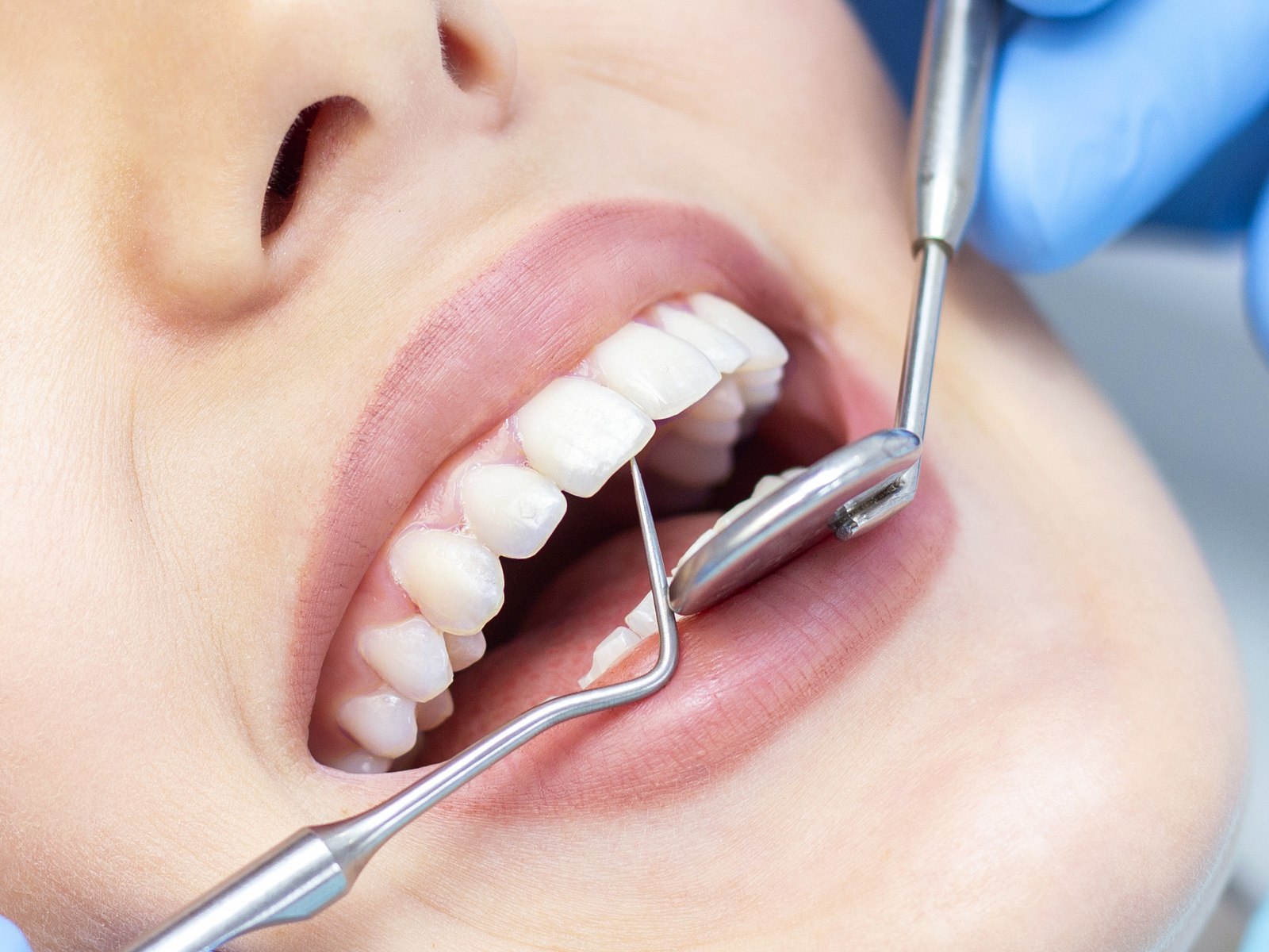 regular teeth cleaning regular teeth cleaning