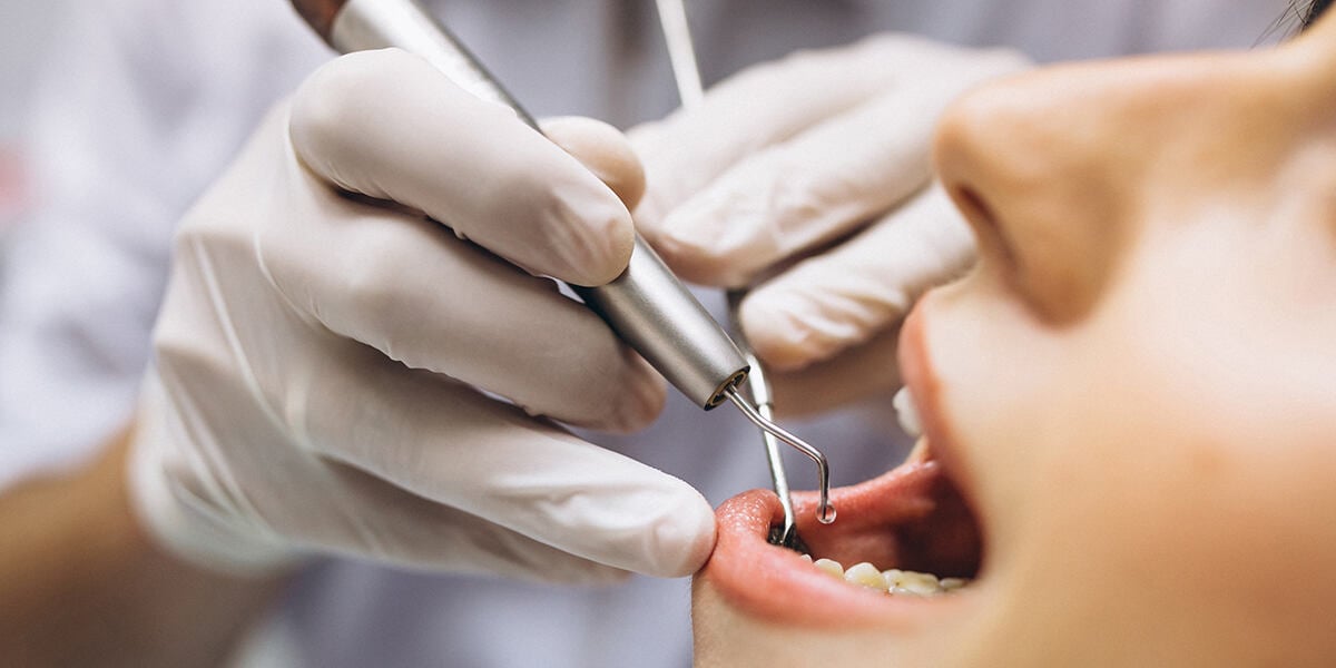 Dental-implant-surgery dental implant surgery operate by scarborough dentist