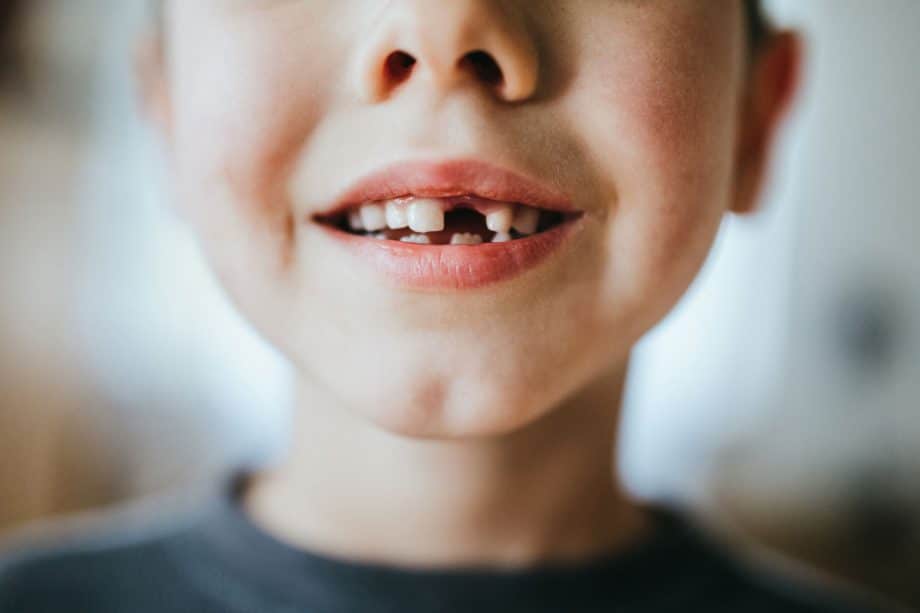 knocked out tooth